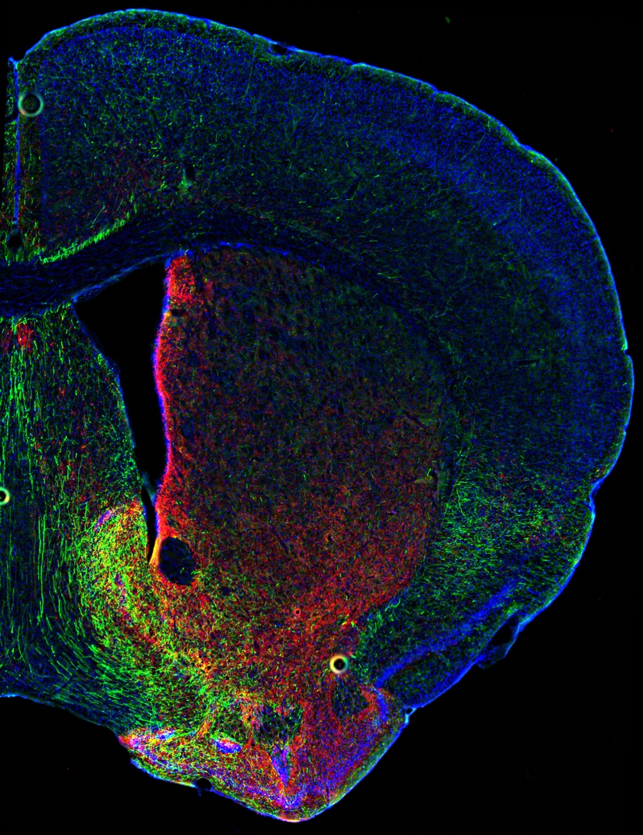    Двойная трансгенная линия мышей позволила одновременно визуализировать и контролировать дофаминовые и серотониновые нейроны у животных. На срезе корональной части мозга (фото выше) показано перекрытие дофамин- и серотонин-содержащих нервных волокон в прилежащем ядре /Daniel Cardozo Pinto, Malenka Lab, Stanford University