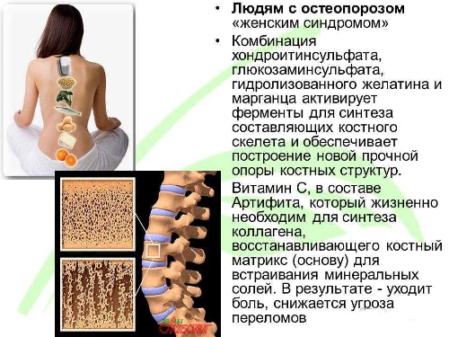 Для укрепления костных тканей нужно употреблять молочные продукты, бобовые,  
 Для укрепления костей нужно употреблять молочные продукты, бобовые, крестоцветные, морепродукты, яйца, различные сыры и цитрусовые