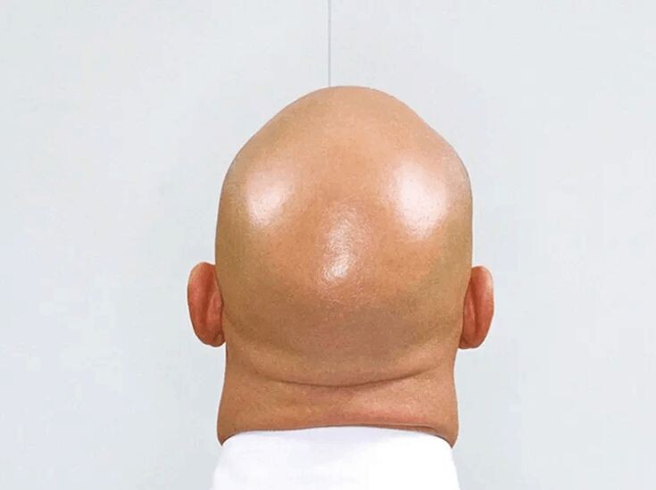 На таком плацдарме интеллекту трудно удержаться...