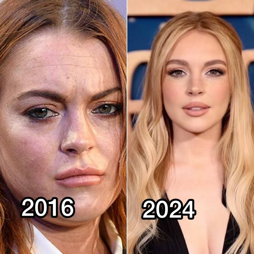 Один из немногих примеров, когда с разницей в 8 лет человек реально помолодел и похорошел