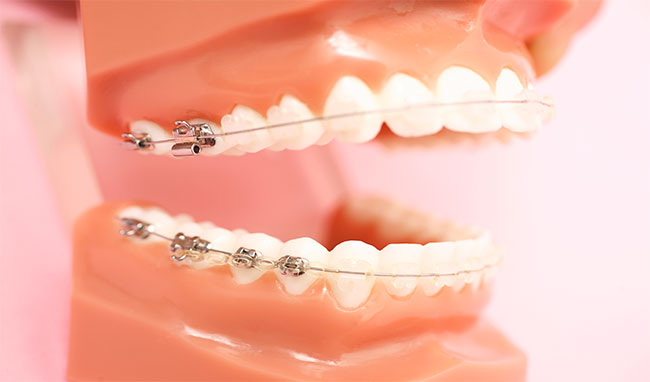 Для увеличения этих зубов можно использовать пластыри, виниры и коронки