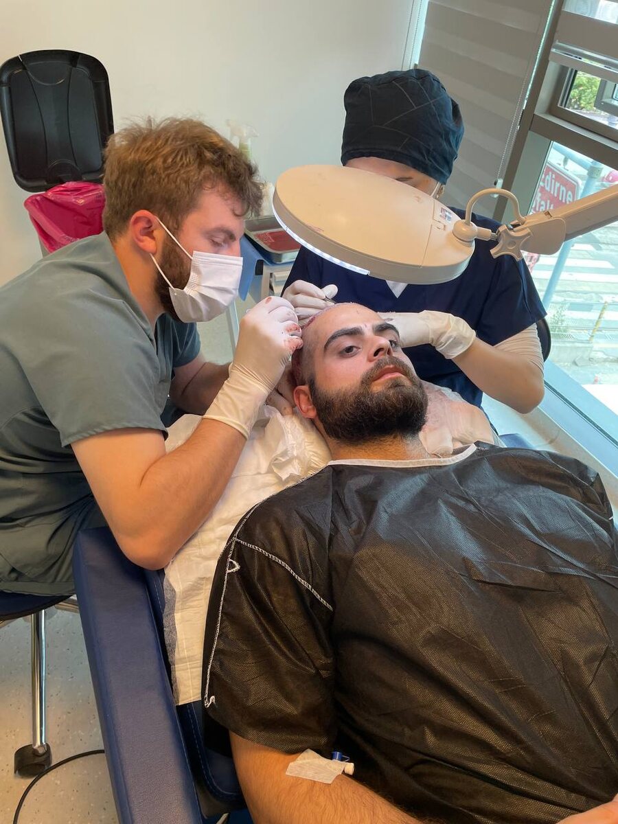 Операция по пересадке волос в Стамбуле