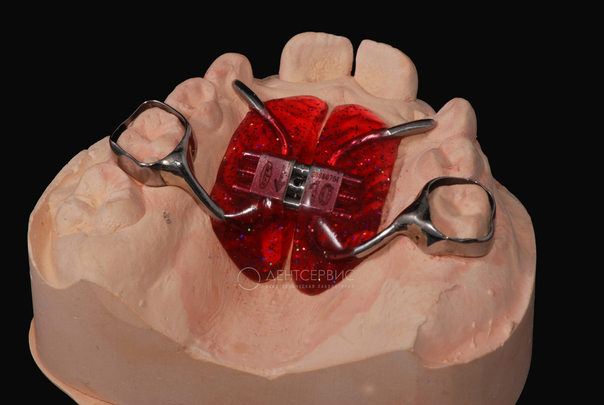 Цвета пластин могут отличаться