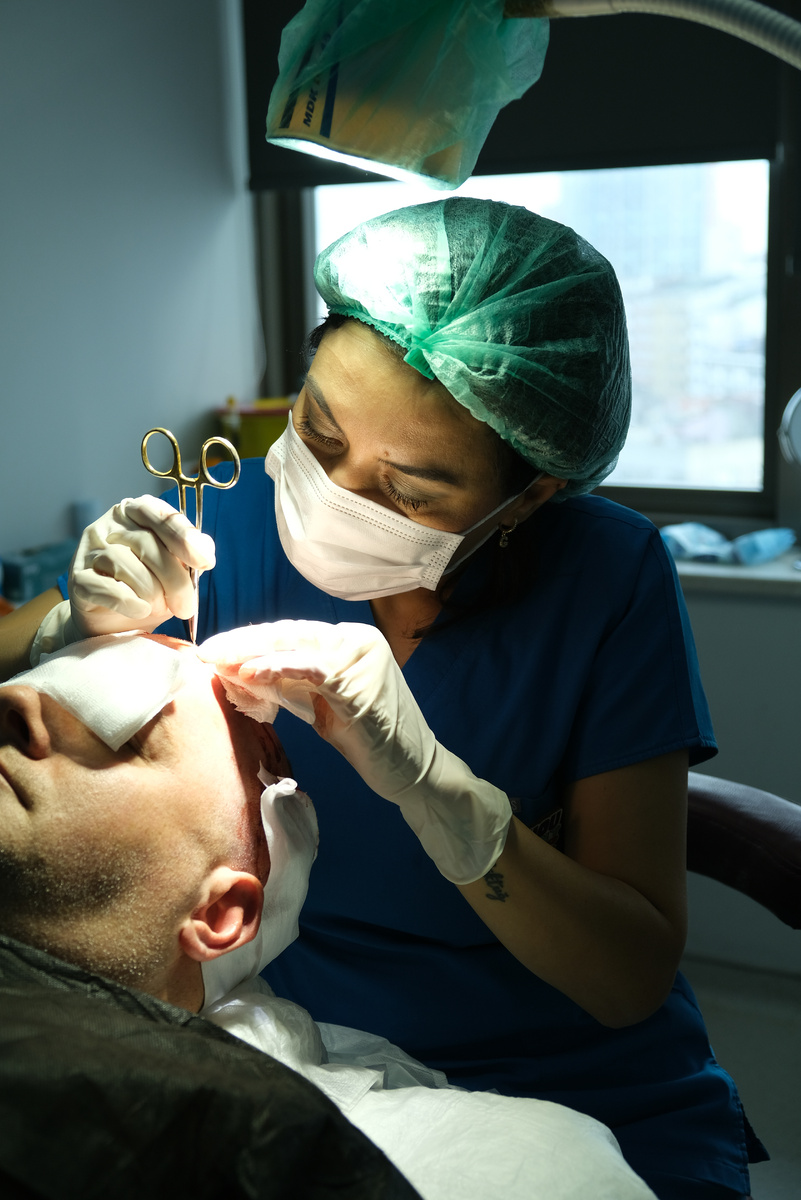 Операция по пересадке волос в стамбульской клинике