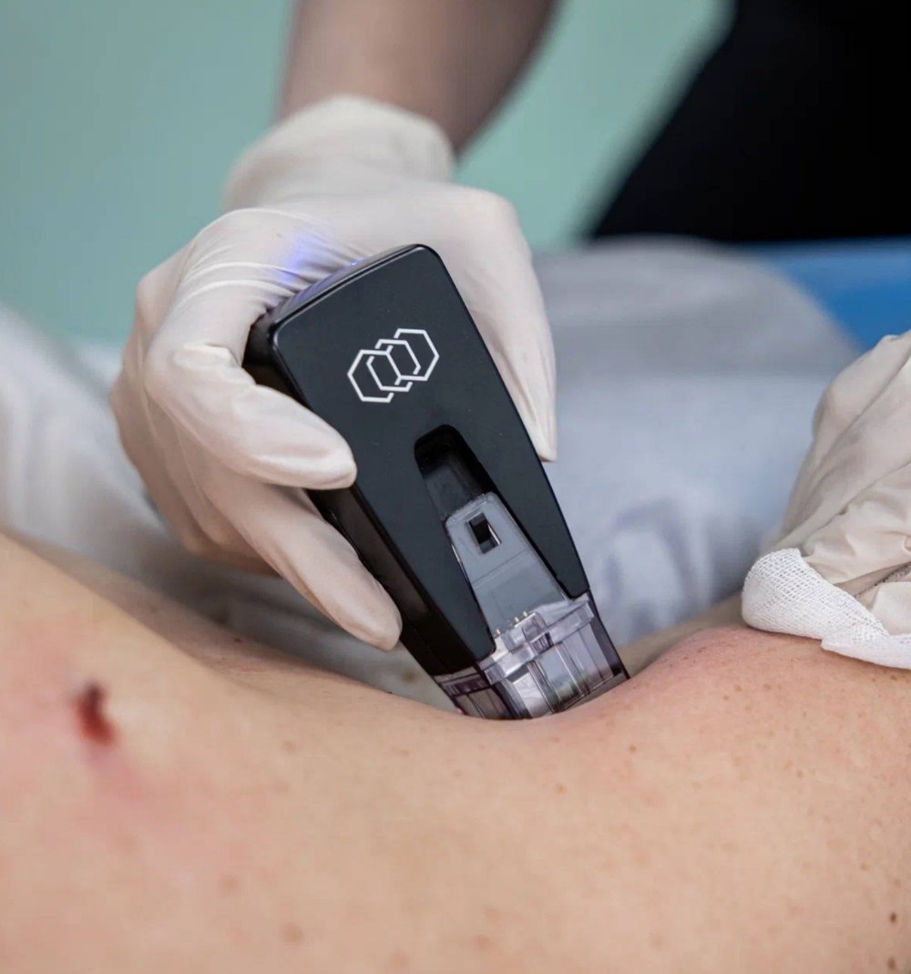 Фото пациента пластического хирурга Анны Соловьевой