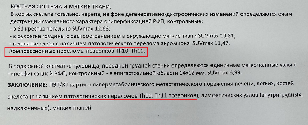Th10 - это 10й гудной позвоной, Th11 - это 11й грудной позвонок.