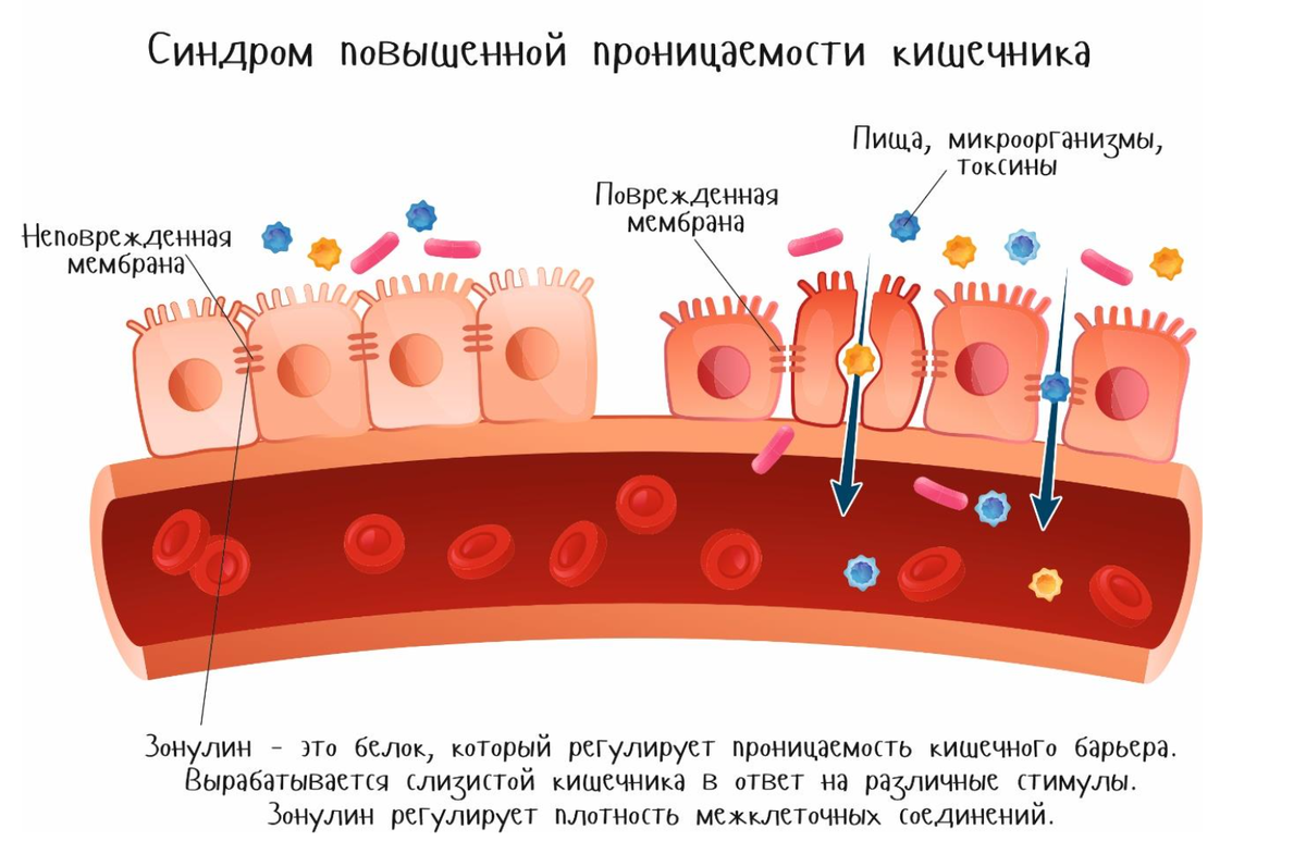 Материал для статьи взят из моей книги "Еда - как лекарство" в 2х томах.