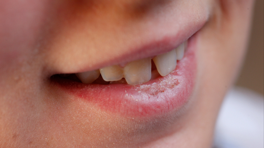    Фото: www.globallookpress.com/Fred de Noyelle/GODONG