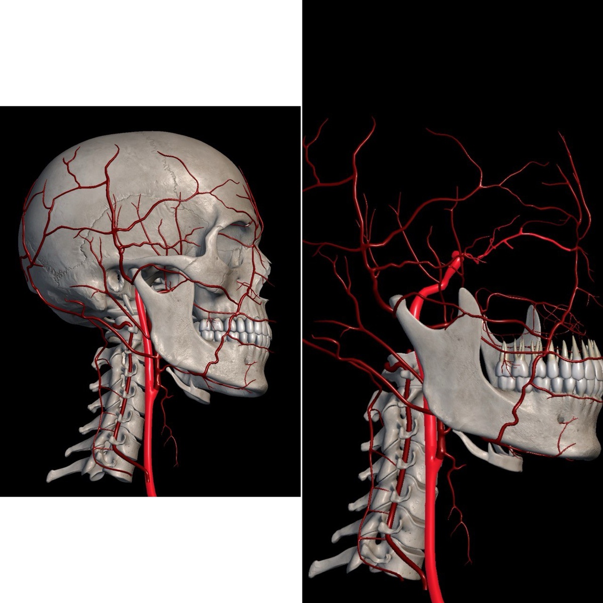 Рис. 1, Слева - внутренняя сонная артерия, справа - вн. сонная и глазная артерии