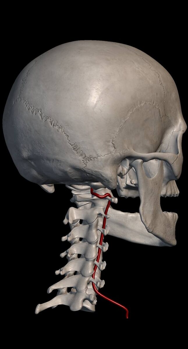Рис. 2 Позвоночная артерия, питающая зрительный центр мозга