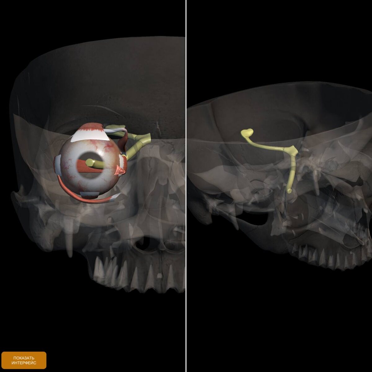 Рис. 3 Мышцы глаза и Зрительный нерв (желтый)