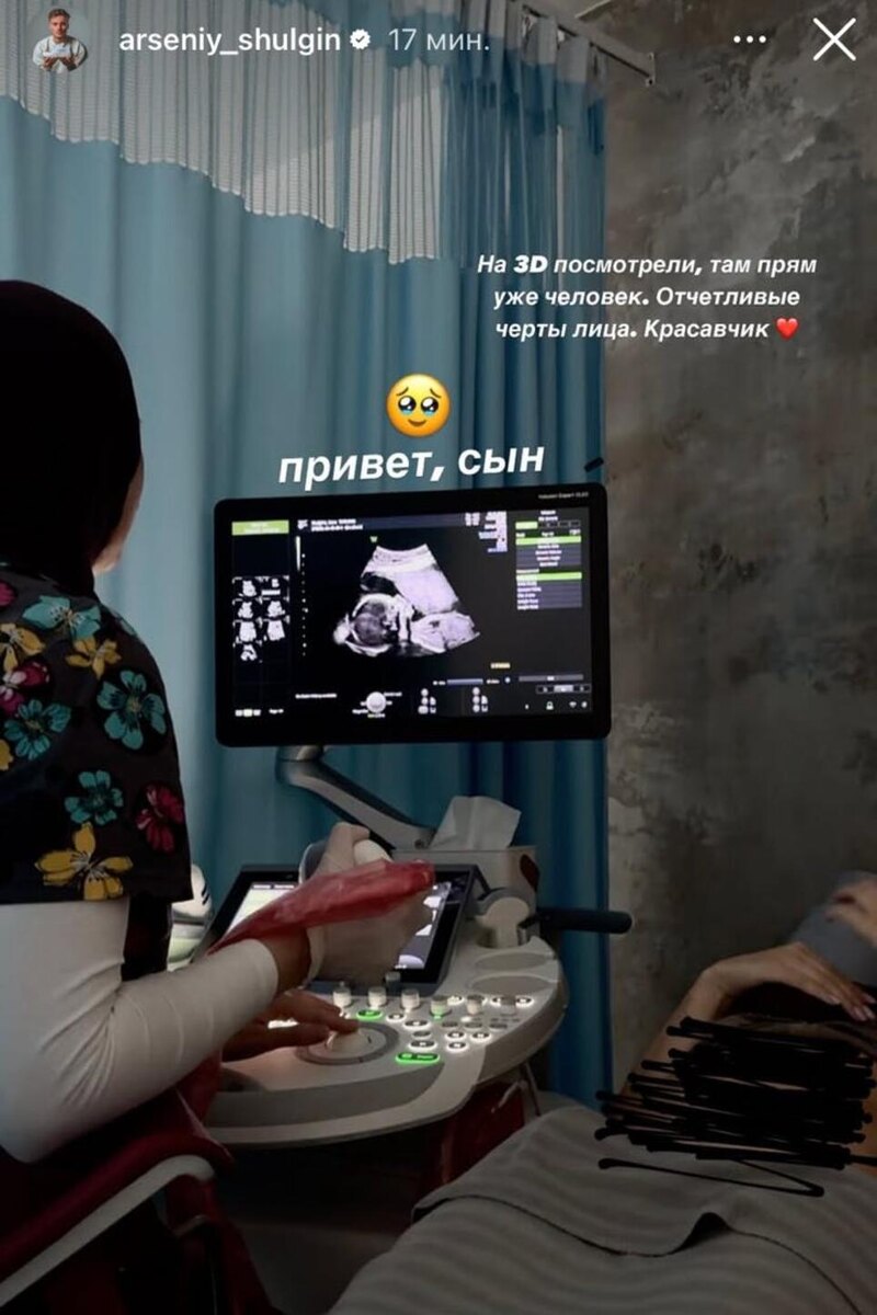    Фото УЗИ сына Арсения Шульгина Соцсети
