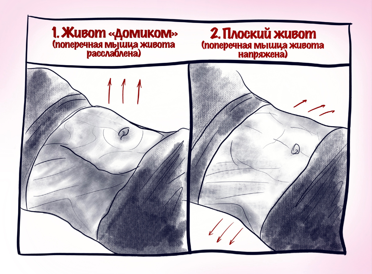 1. Неправильное сокращение мышц живота; 2. Верное сокращение