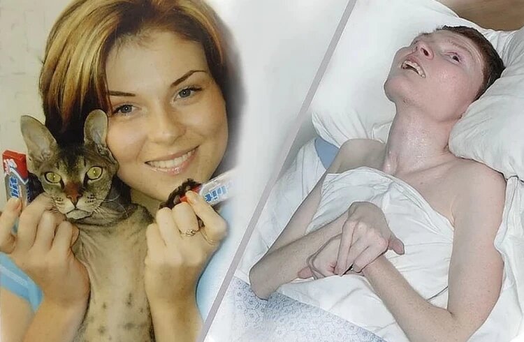 Пострадавшая в «Хромой лошади» Ирина Пекарская больше 10 лет была прикована к кровати

Фото: архив "КП"

