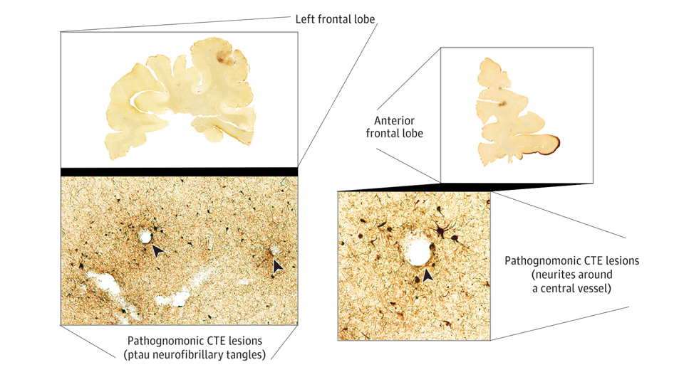   N + 1; Bobak Abdolmohammadi et al. / JAMA Network Open, 2024