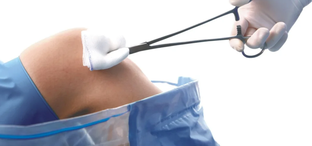 Хирург сказал резать! Не торопимся. Есть секрет.