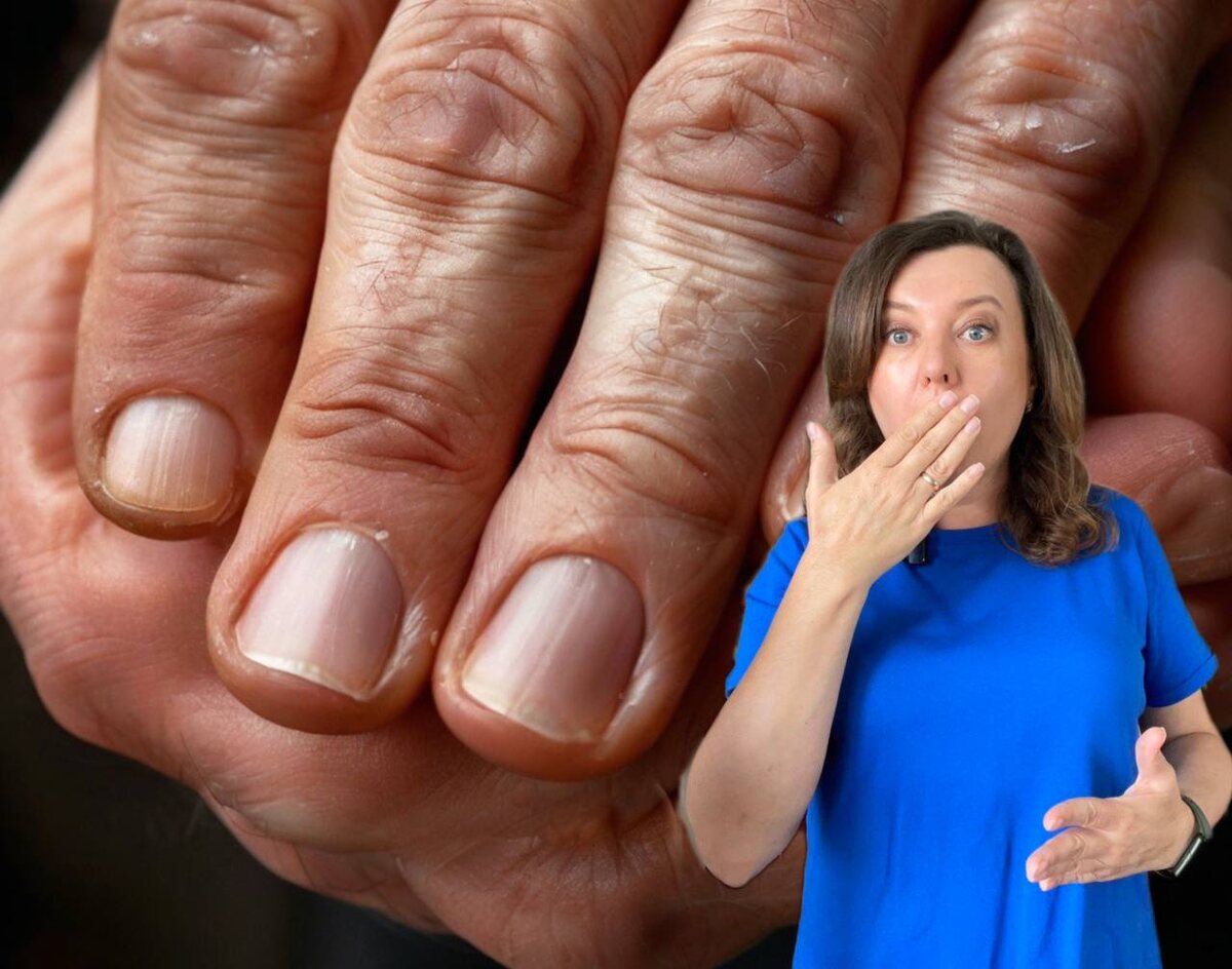 коллаж Другой Кухни / проблемы с ногтями