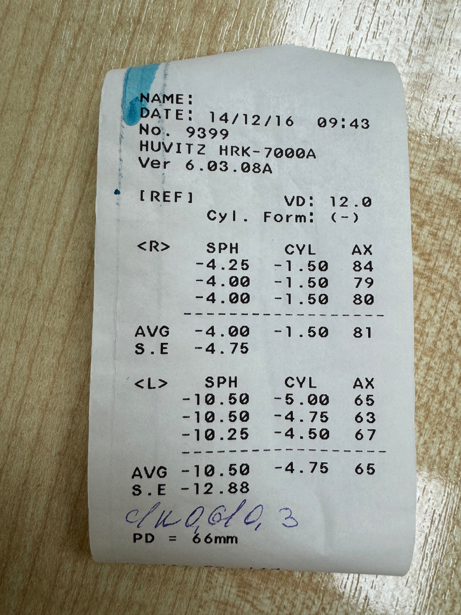 Рефрактометрия пациента 