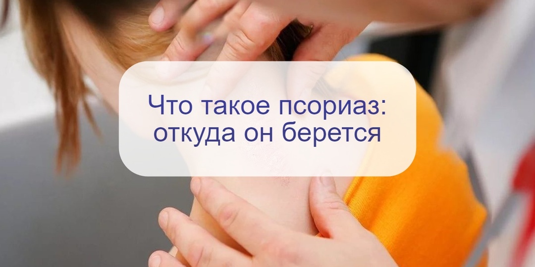 7 декабря – тема дня: псориаз. Почему страдает кожа, можно ли этим заразиться и как это выглядит