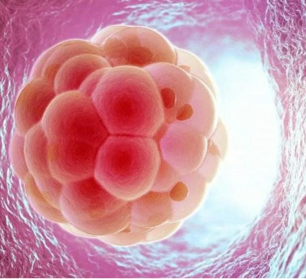 Изображение взято из открытого доступа сети Интернет