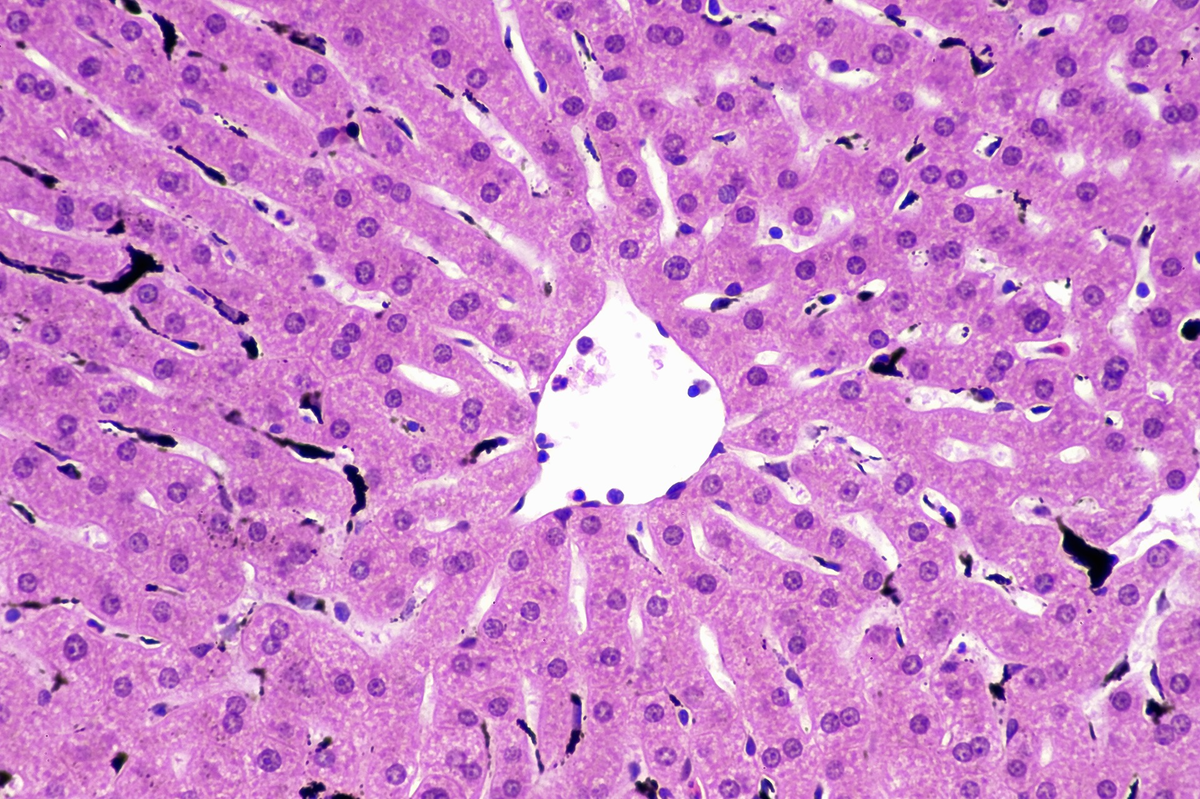 Клетки Купфера, фагоцитирующие частицы углерода. Иллюстрация: iecure.com