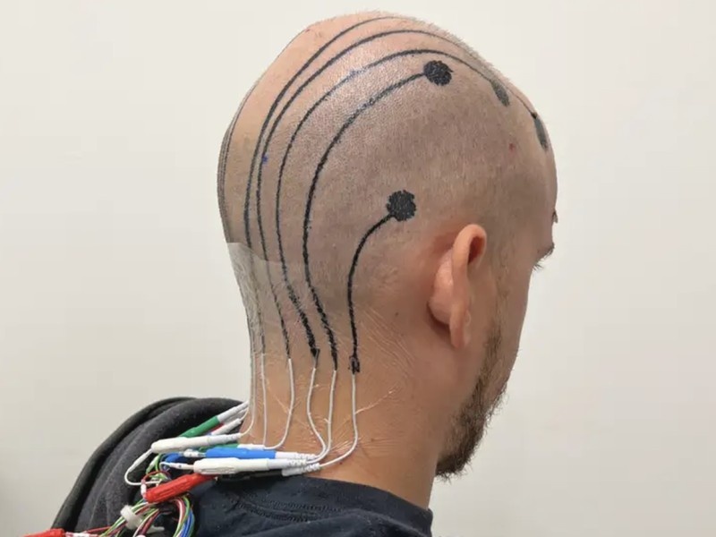    Электронные «татуировки» могут стать альтернативой процедуре ЭЭГ