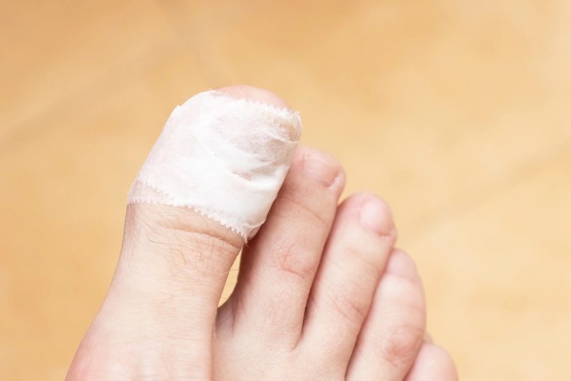 Раневой процесс пальца