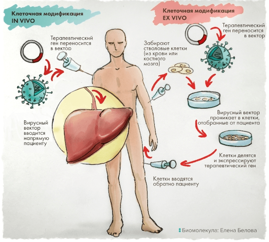 Два подхода к генной терапии. Клетки можно модифицировать «в пробирке» (ex vivo, на изображении справа) или прямо в организме пациента (in vivo, слева).

Иллюстрация Елены Беловой из статьи «Генная терапия: познакомьтесь с лекарствами будущего»