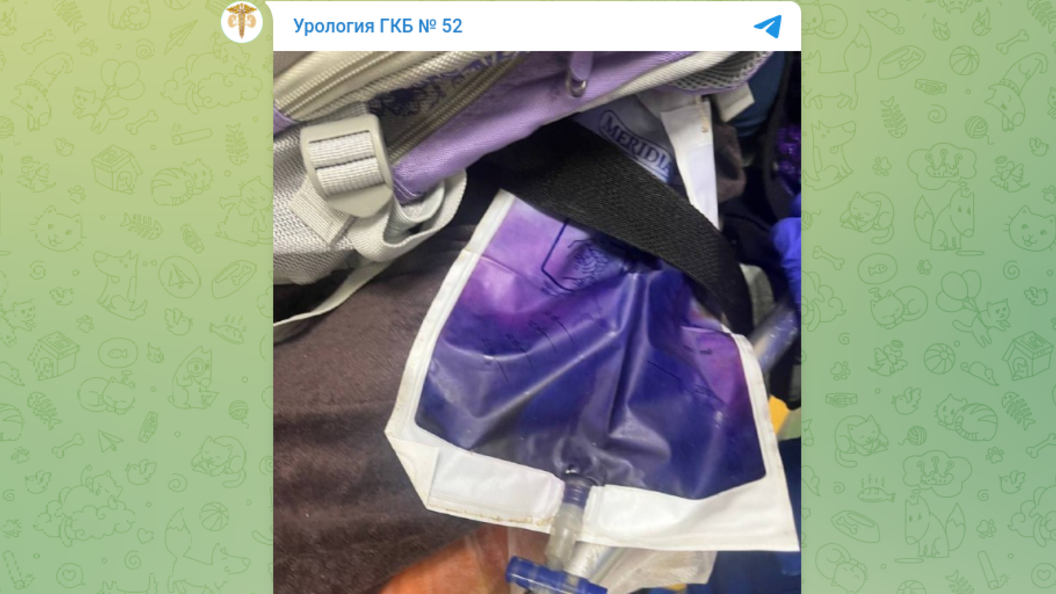    фото: тг-канал урологического отделения Московской городской клинической больницы № 52