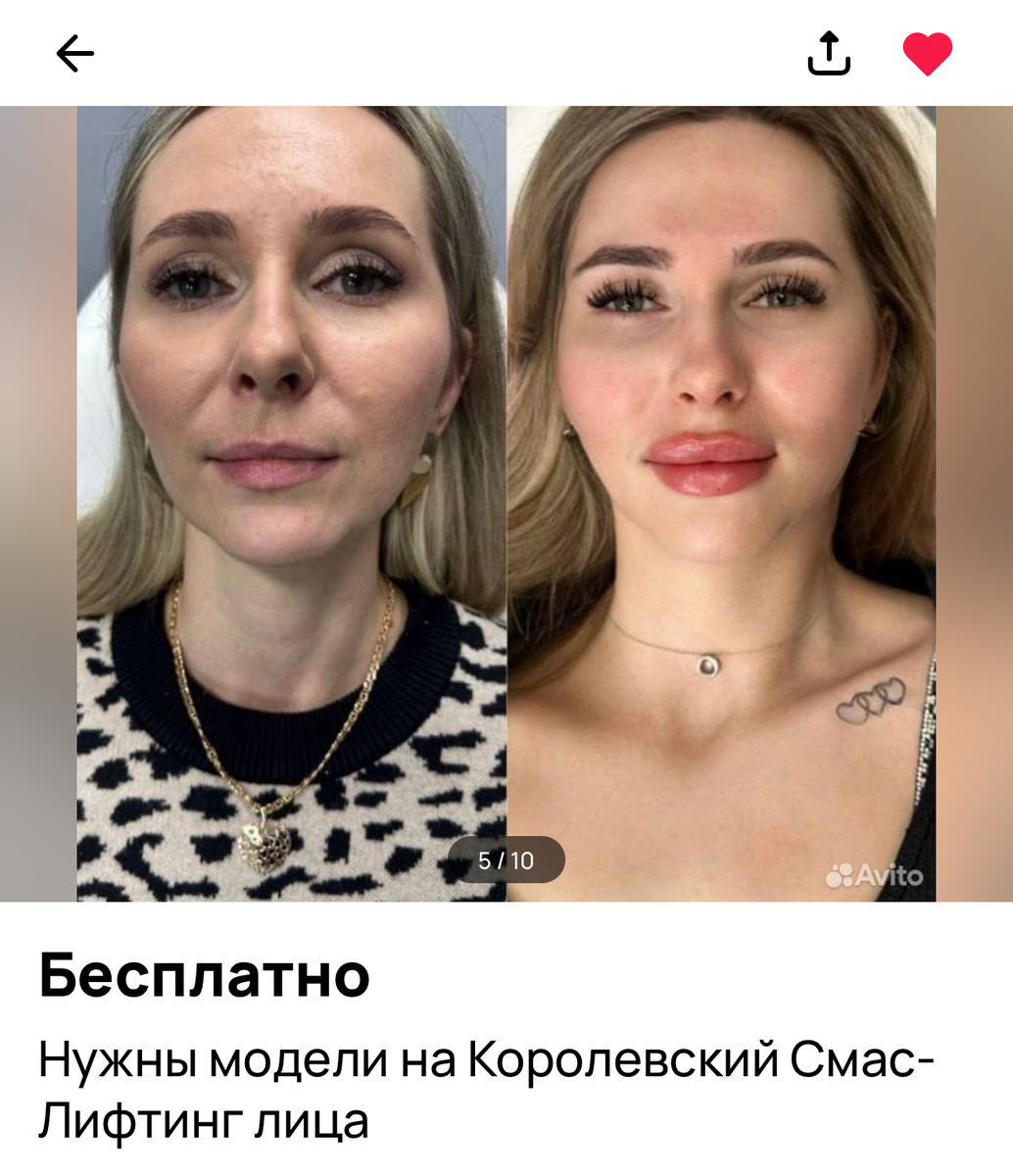 Фото из приложения Авито (кстати без вашего письменного согласия фото использовать не могут) P.S. По идее и я не могу 🙈 но для наглядности рискну 