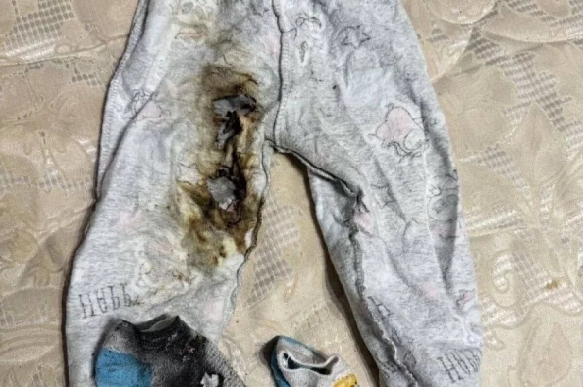    В Удмуртии 9-месячный ребёнок получил ожоги из-за вспыхнувшего телефона