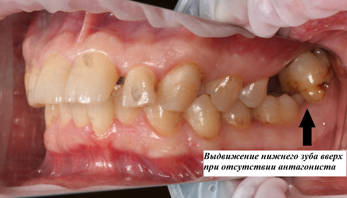 Такая беда за 1 год не случается – труды длиной в десятилетие. 