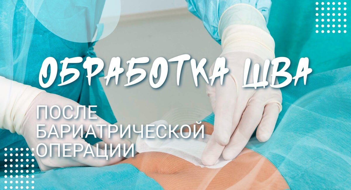 Обработка швов после бариатрической операции