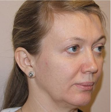 фото из личного архива пациентки