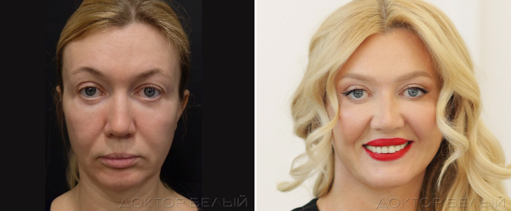 фото из личного архива пациентки