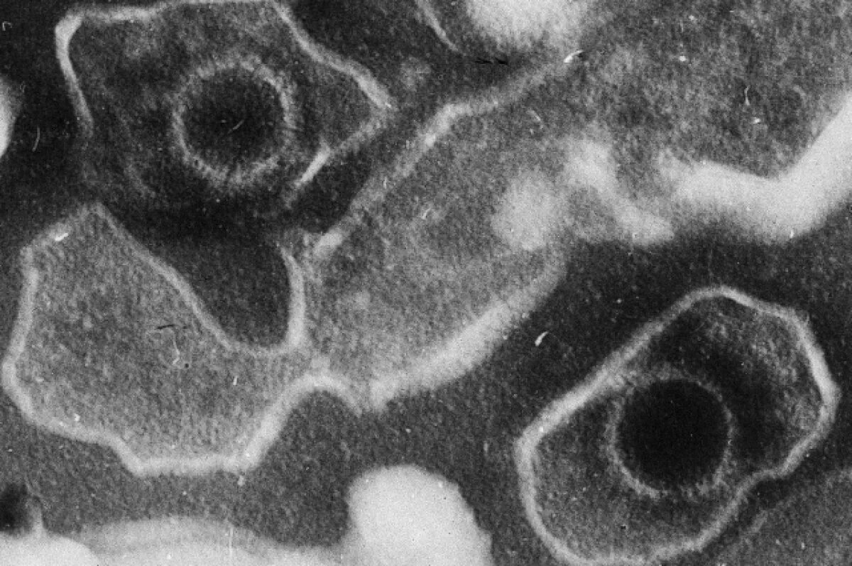    Вирус Эпштейна-Барр.