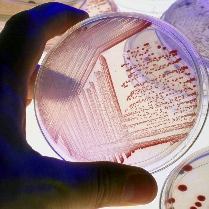 Источник: https://womanadvice.ru/klebsiella-pnevmoniya