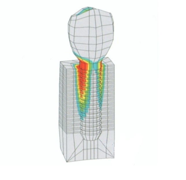 Анализ показывает концентрацию основной нагрузки в области первых 6 мм имплантата