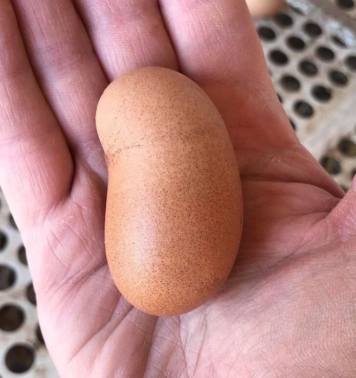 Строение яичка анатомия. Семенной канатик топография. Оболочки яичка топографическая анатомия. Что то с яичками. Сагиттальный разрез яичка.