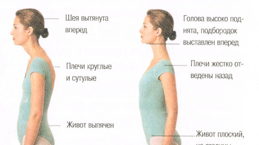 Как убрать компьютерную шею. Шея выдвинута вперед. Как исправить шею вытянутую вперед. Осанка и подбородок. Положение шеи.
