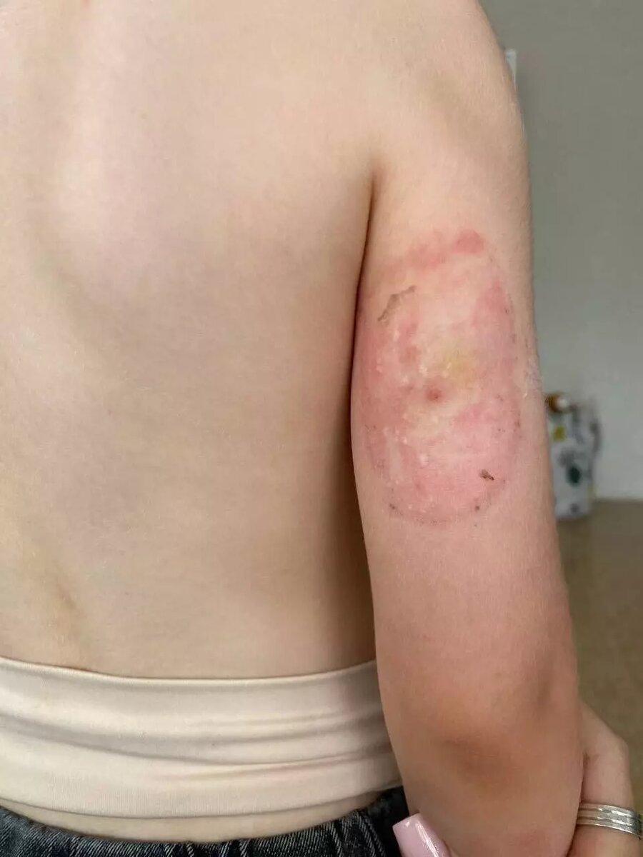 Датчик СТ 14 вызывает аллергию у больных детей. Фото: newizv.ru