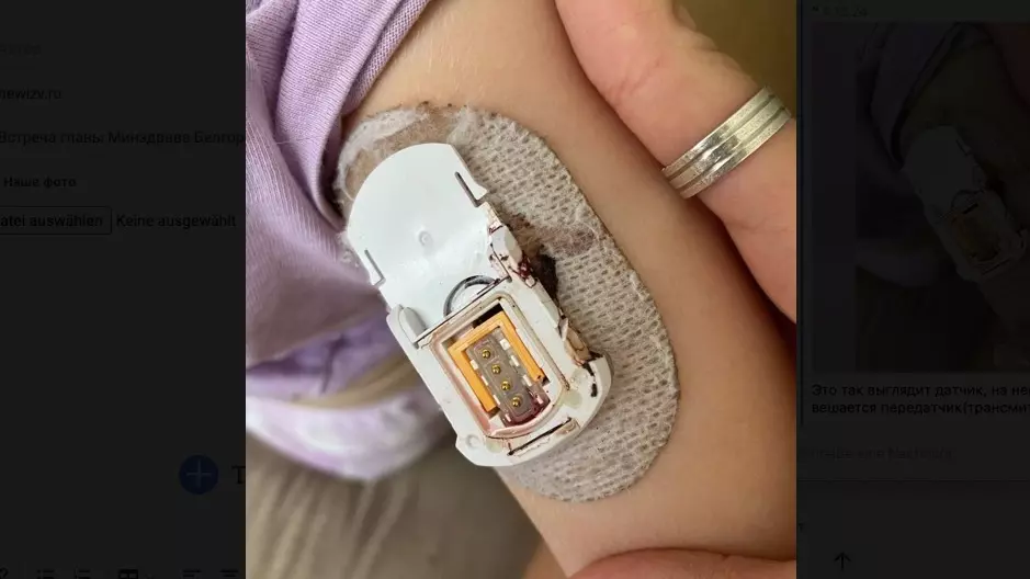 Глюкометр раздора. В Белгородской области родители выступили против Минздрава. Фото: newizv.ru