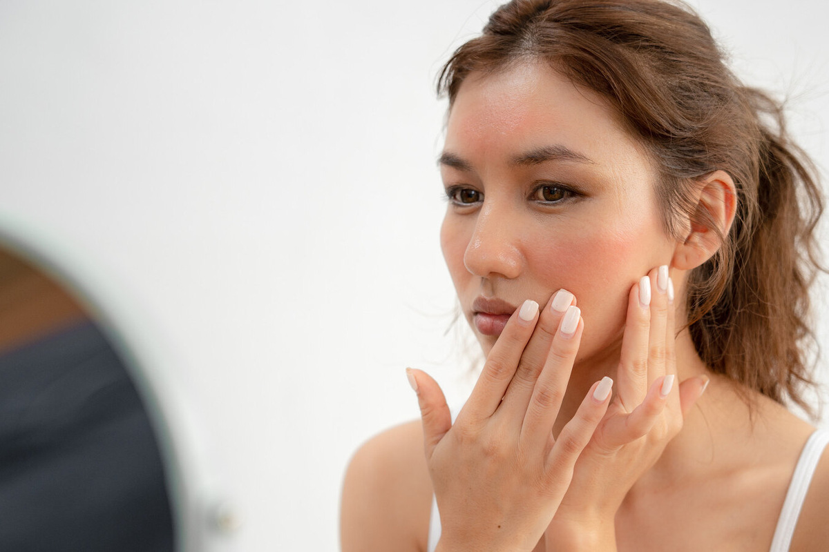     Как быстро убрать красноту с лица: 4 простых лайфхака от дерматологов