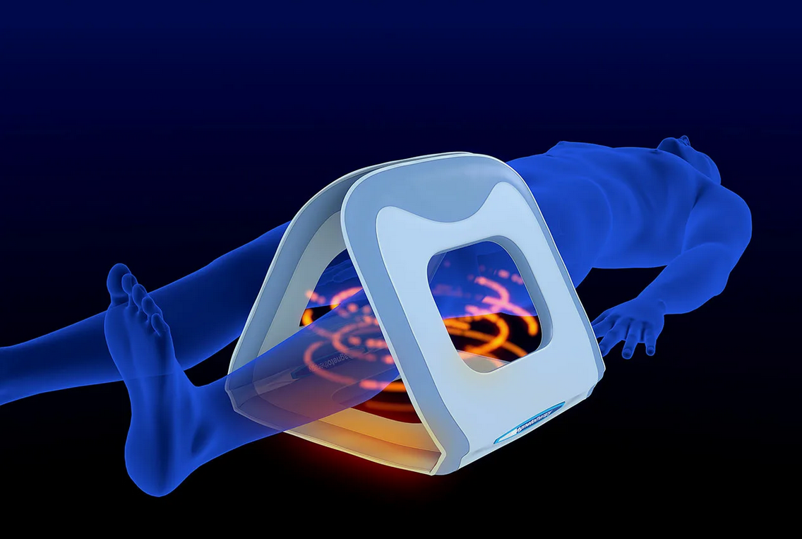 Процесс магнитотерапии