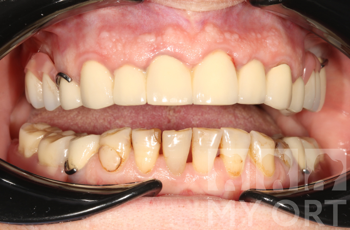 СитуацияДО. Вид спереди