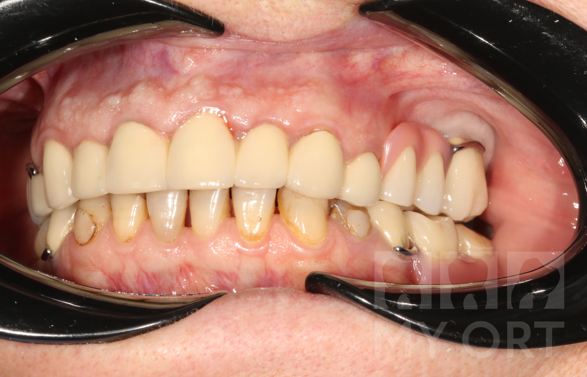 Ситуация ДО. Вид сбоку