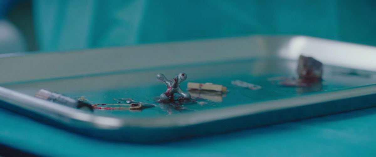 извлечённые из желудка Хантер предметы 