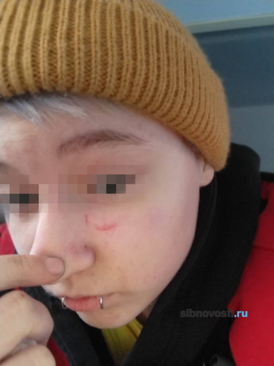    Фото предоставлено героиней публикации. Так сейчас выглядит лицо одной из девочек
