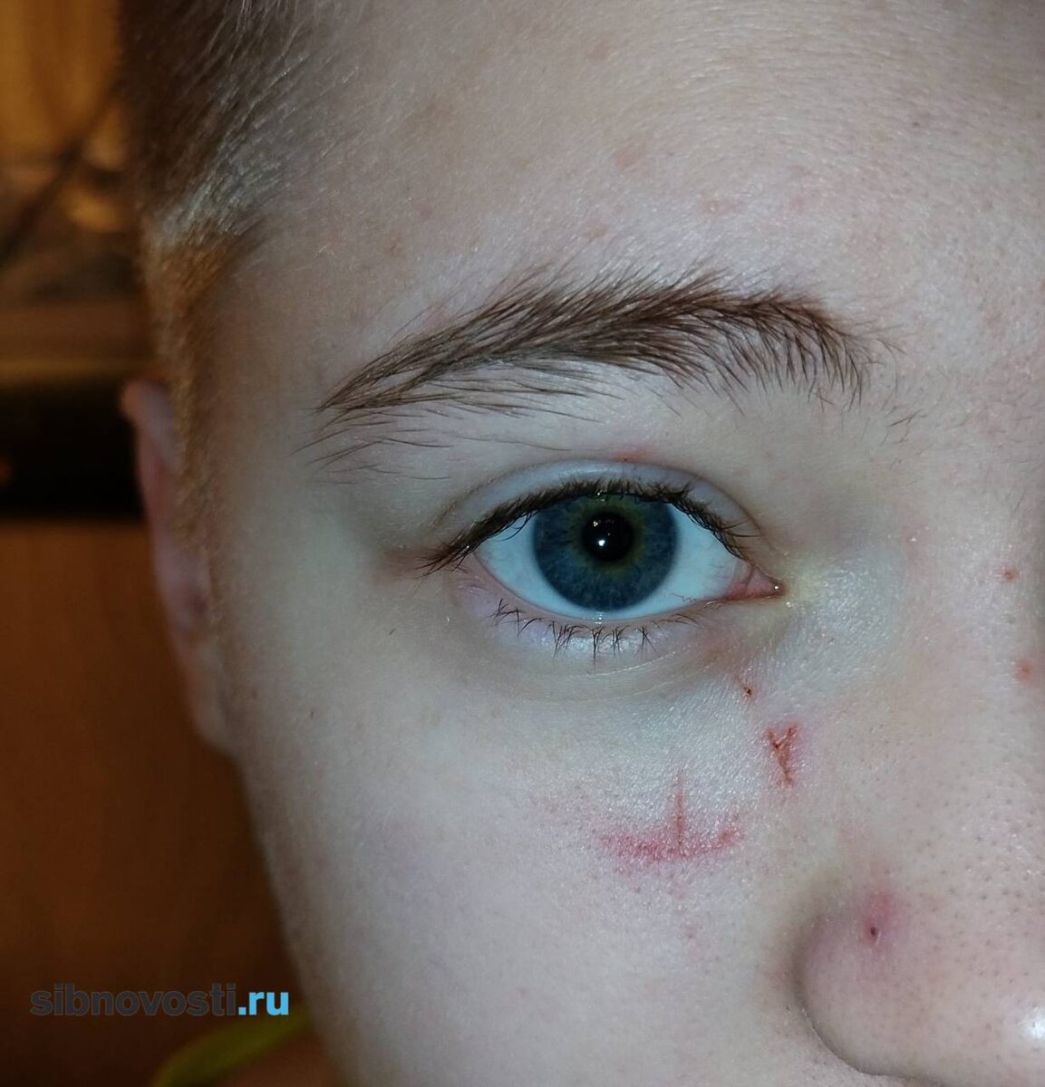    Фото предоставлено героиней публикации. Так сейчас выглядит лицо одной из девочек