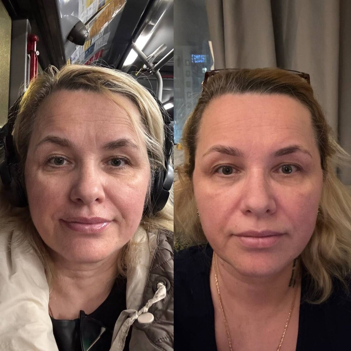 Фото без фильтров до/после